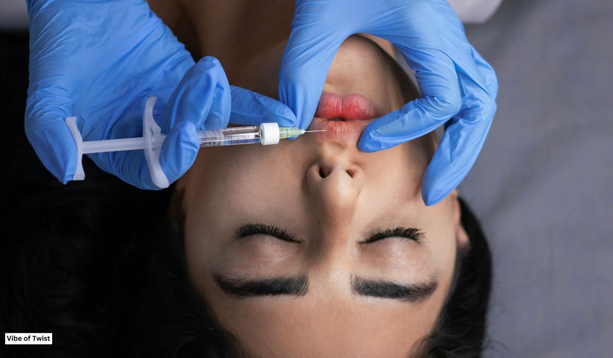 Work Out After Lip Fillers